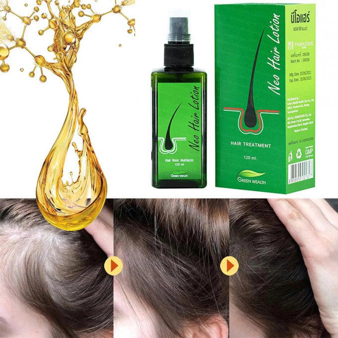 Neo Hair – Loción verde de Tailandia, aceite en spray para el crecimiento del cabello